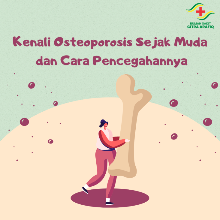 Kenali Osteoporosis Sejak Muda dan Cara Pencegahannya