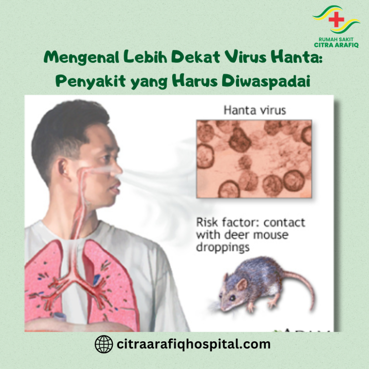 Mengenal Lebih Dekat Virus Hanta: Penyakit yang Harus Diwaspadai